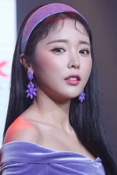 홍진영 성형고백 (사진=연합뉴스)
